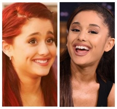 Ariana Grande Before and After - See How Much She's Changed!