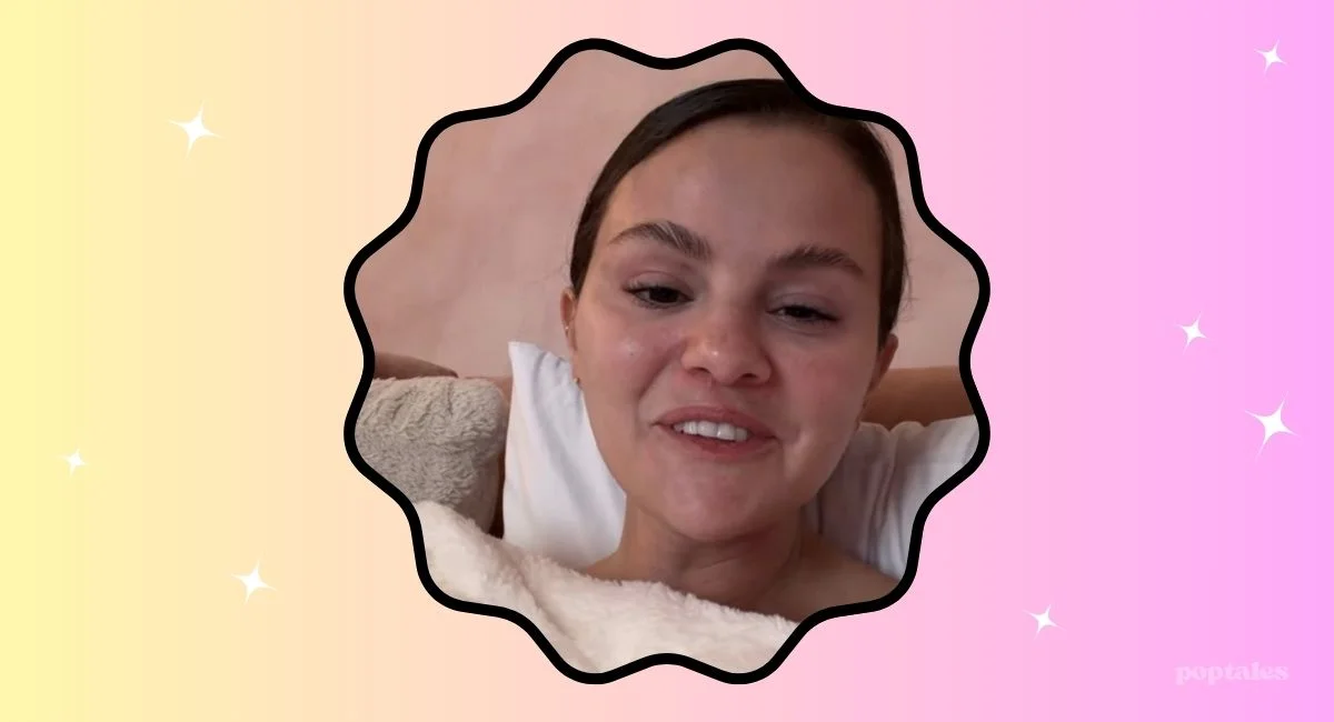 selena gomez melasma