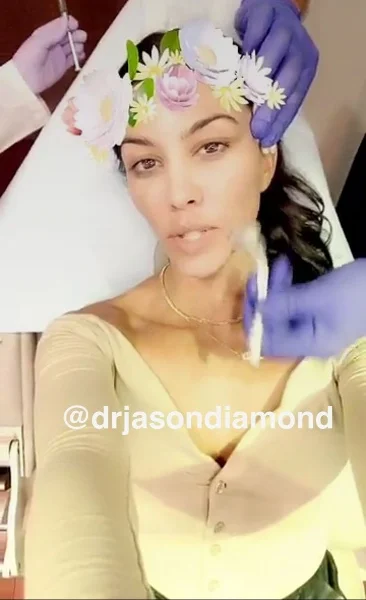 Kourtney Kardashian microneedling
