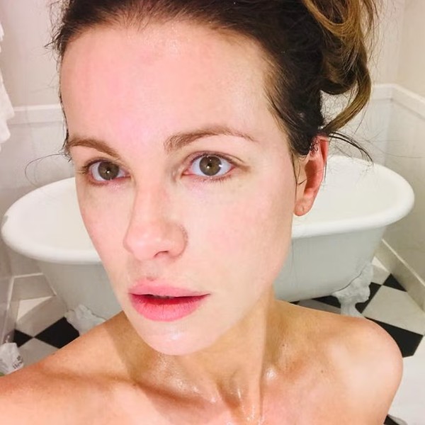 kate beckinsale microneedling