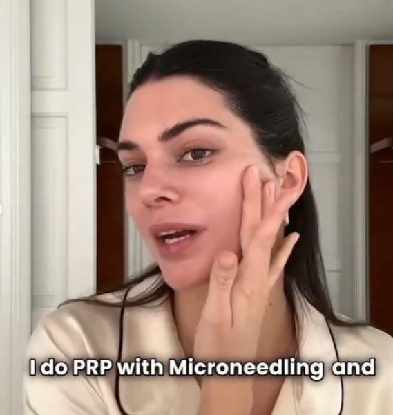 kendall jenner microneedling